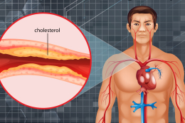 Cholesterol - hodnoty v tabulce podle věku