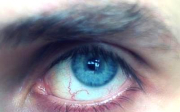 Domácí léčba červených žilek v očích